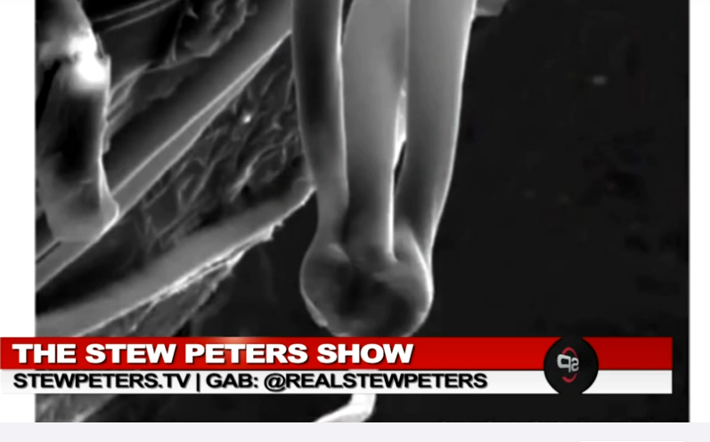 The Stew Peters Show - aluminum-based parasites