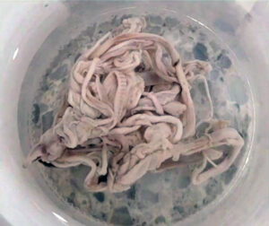 A bowl full of "clots" pulled from the veins and arteries of people who died after accepting the mRNA shots.